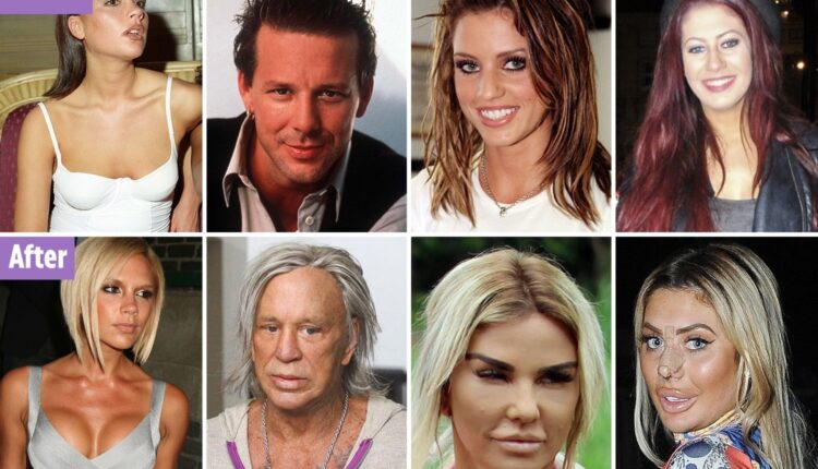 Celebrities who regret cosmetic surgery like 'disfigured' Linda Evangelista